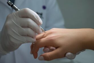 Hornzipfel: Was steckt dahinter und was hilft wirklich?